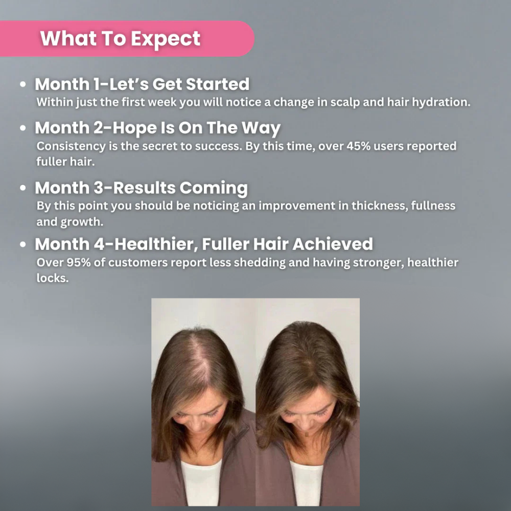 Shekys Micro-Infusion Hair Regrowth System