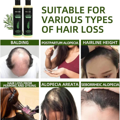 Shekys Rosemary Hair Growth Shampoo