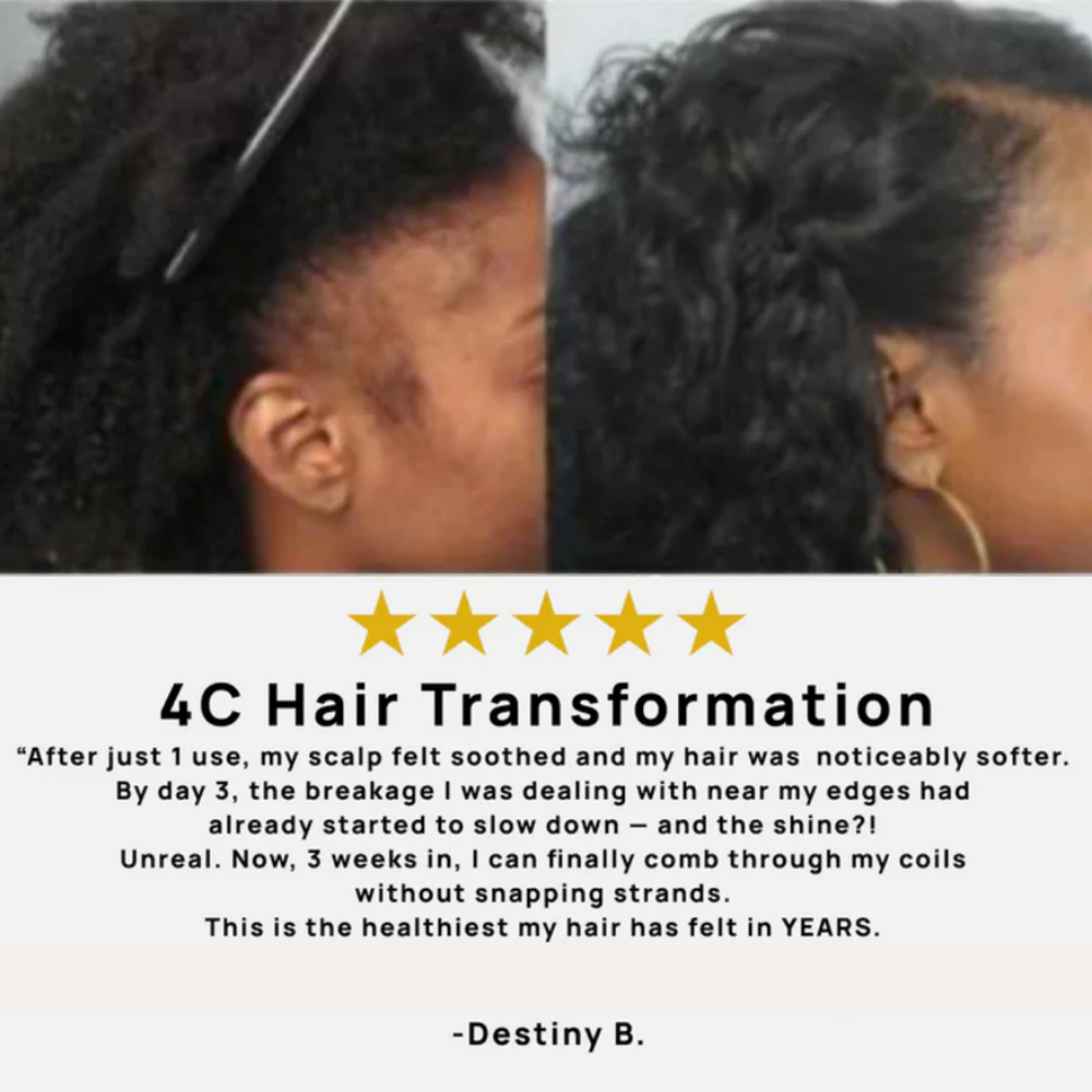 Shekys Micro-Infusion Hair Regrowth System