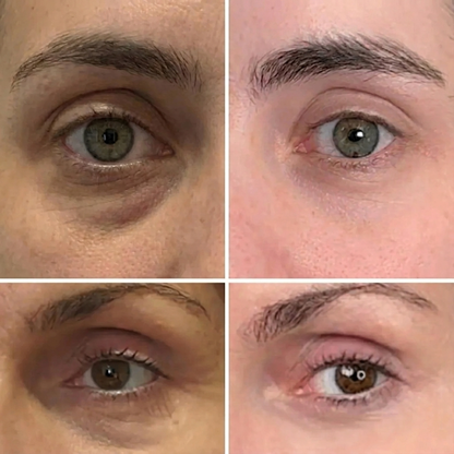 PDRN Collagen & Volufiline Balm