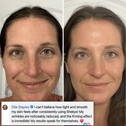 PDRN Collagen & Volufiline Balm